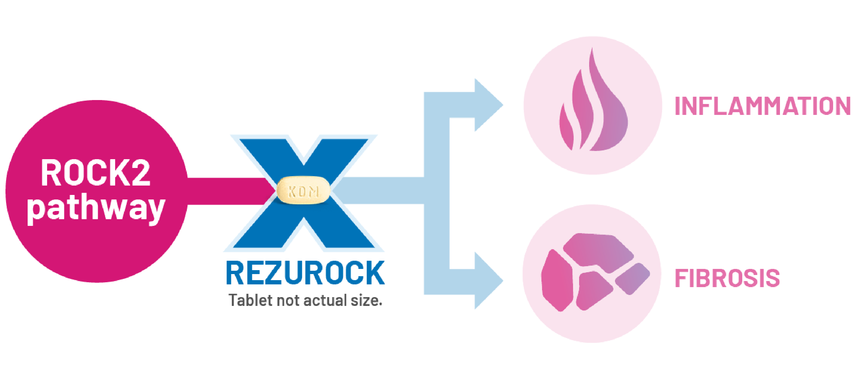 Infographic showing a tablet on "X" symbol above REZUROCK with the text "Tablet not actual size" blocking the ROCK2 pathway's progression toward inflammation and fibrosis.